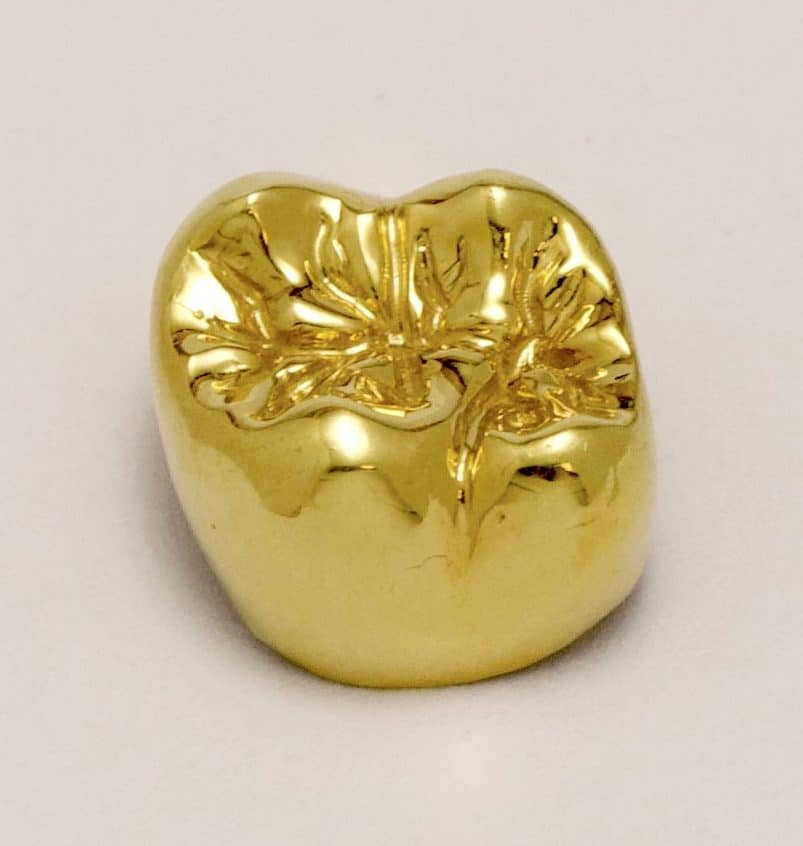 Full Contoured Gold Crown