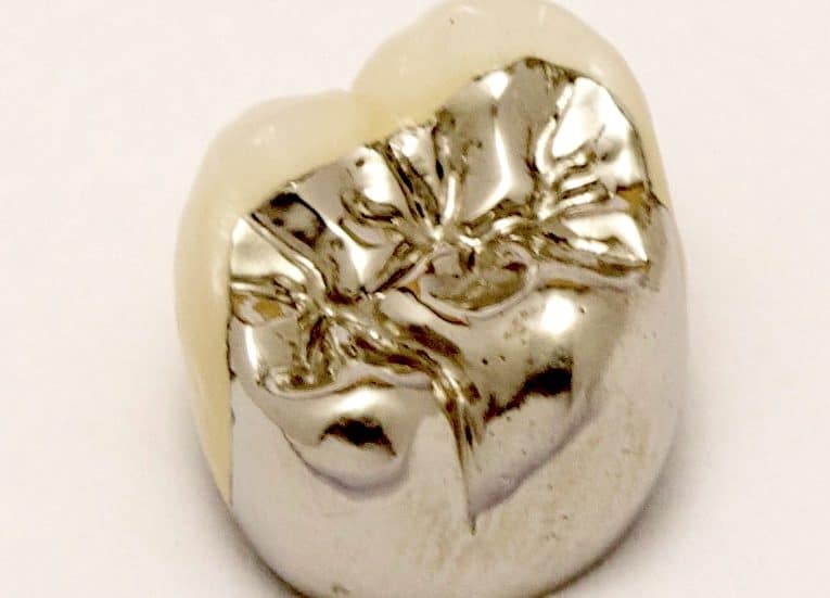 PFM Metal Occlusal