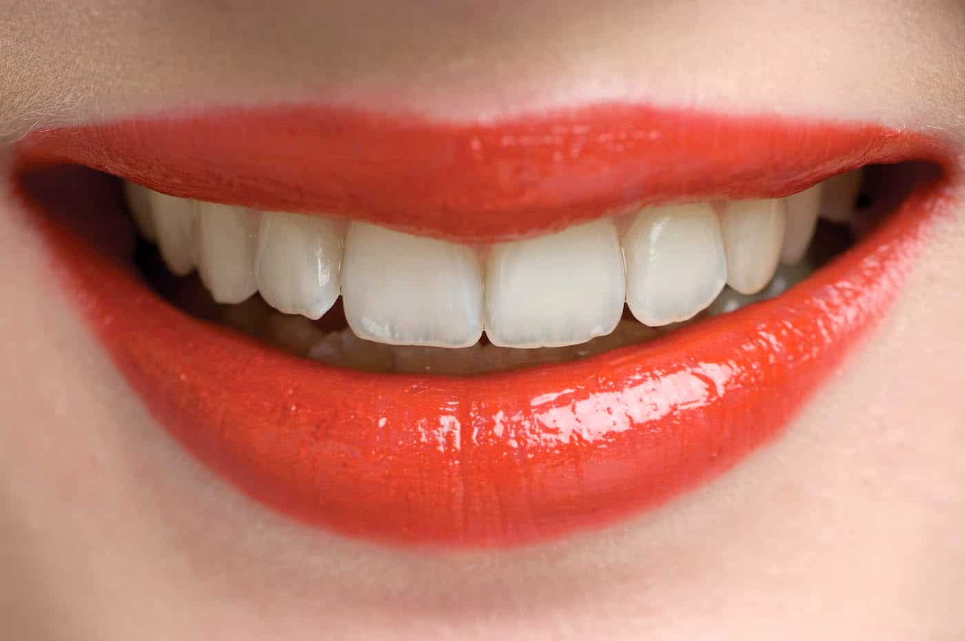 The Art Of Aesthetics Cosmetic Porcelain Veneers